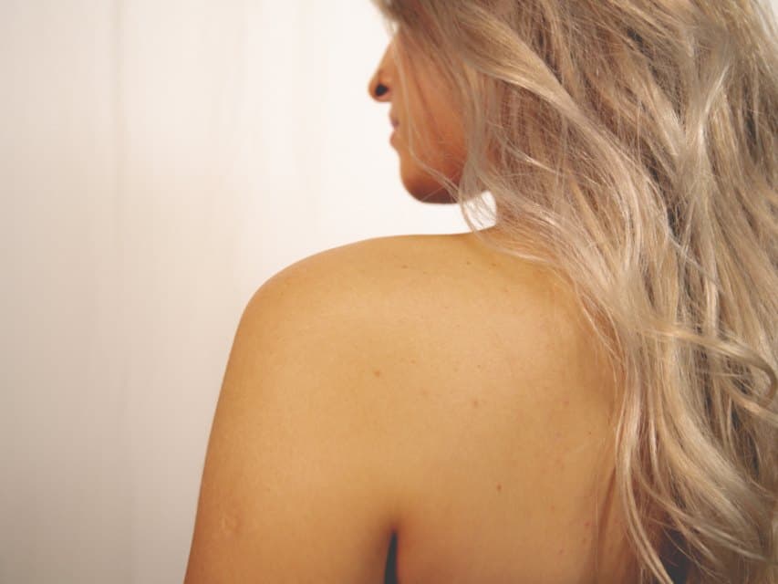 Épaule, avant le tatouage